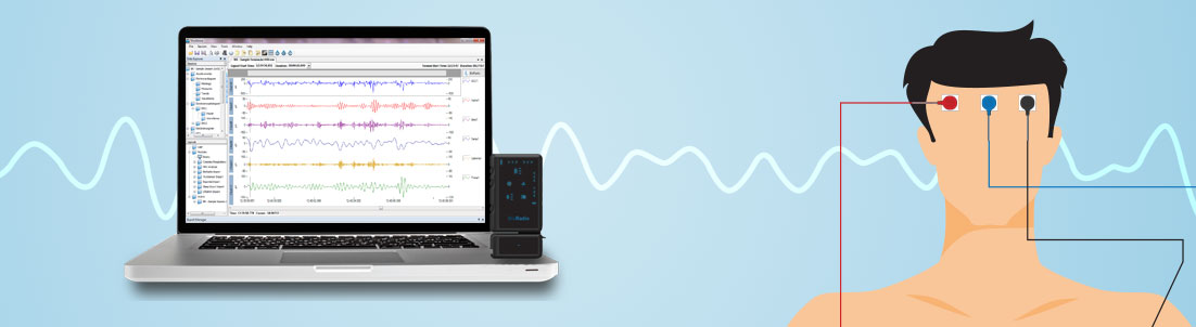 EEG – Great Lakes NeuroTechnologies